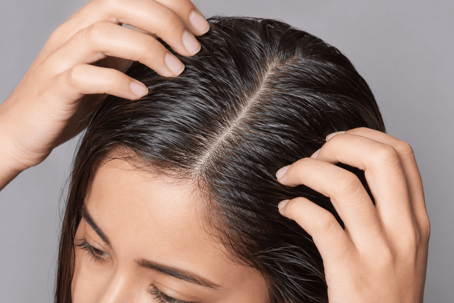 greasy scalp & hair