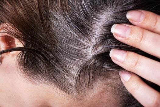 Scalp Detox
